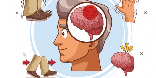 Parkinson's Disease And Multiple Sclerosis: Differences And Similarities